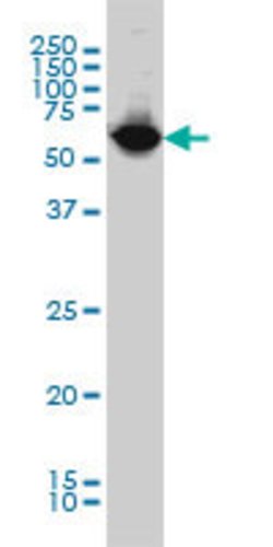 NARS, Mouse anti-Human, Clone: 2D6, Abnova 100&mu;g; Unconjugated:Antibodies,