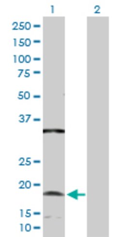 NDUFC2, Rabbit anti-Human, Polyclonal Antibody, Abnova 100&mu;g; Unconjugated:Antibodies,