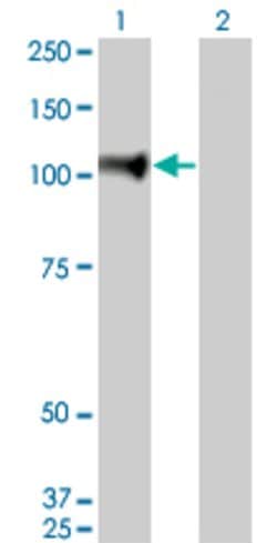 NELL1, Mouse anti-Human, Clone: 6A8, Abnova 100&mu;g; Unconjugated:Antibodies,
