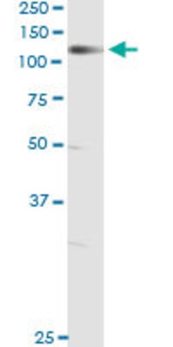 NELL1, Mouse anti-Human, Clone: 6A8, Abnova 100&mu;g; Unconjugated:Antibodies,