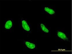 NFYC, Mouse anti-Human, Clone: 1D3, Abnova 50&mu;g; Unconjugated:Antibodies,