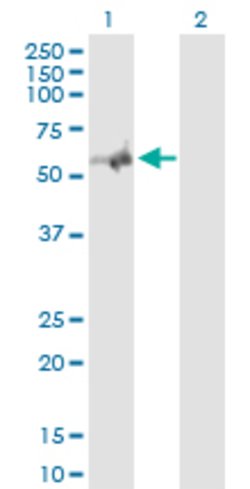 NGFR, Rabbit anti-Human, Polyclonal Antibody, Abnova 100&mu;g; Unconjugated:Antibodies,