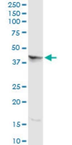 NGFR, Rabbit anti-Human, Polyclonal Antibody, Abnova 100&mu;g; Unconjugated:Antibodies,