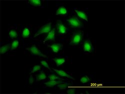 NME1, Mouse anti-Human, Clone: 2H1, Abnova 100 &mu;g | Buy Online | Abnova | Fisher Scientific