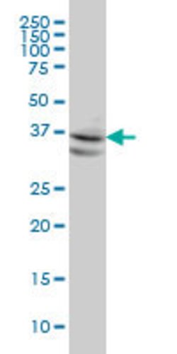 NODAL, Mouse anti-Human, Clone: 5H3, Abnova 100&mu;g; Unconjugated:Anticorps,