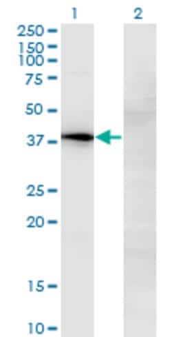 NOV, Mouse anti-Human, Clone: 2G8, Abnova 100&mu;g; Unconjugated:Antibodies,