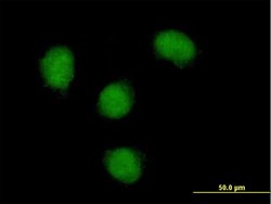 NOVA1, Mouse anti-Human, Polyclonal Antibody, Abnova 50&mu;g; Unconjugated:Antibodies,