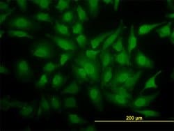 YBX1, Mouse anti-Human, Clone: 4F12, Abnova 100&mu;g; Unconjugated:Antibodies,