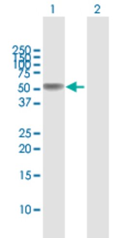 TNFRSF11B, Rabbit anti-Human, Polyclonal Antibody, Abnova 100&mu;L; Unconjugated:Antibodies,