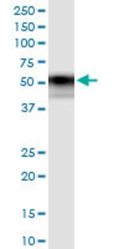 TNFRSF11B, Rabbit anti-Human, Polyclonal Antibody, Abnova 100&mu;L; Unconjugated:Antibodies,