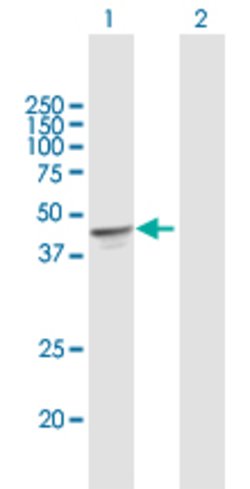 OXA1L, Mouse anti-Human, Polyclonal Antibody, Abnova 50&mu;g; Unconjugated:Antibodies,