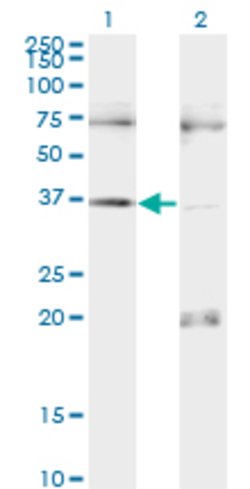 PAX9, Mouse anti-Human, Clone: 3B8, Abnova 100&mu;g; Unconjugated:Antibodies,