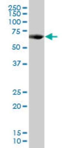PCK1, Mouse anti-Human, Polyclonal Antibody, Abnova 50&mu;g; Unconjugated:Antibodies,