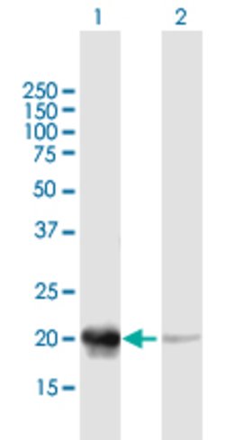 PDC, Mouse anti-Human, Polyclonal Antibody, Abnova 50&mu;g; Unconjugated:Antibodies,