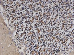 PDE9A, Mouse anti-Human, Clone: 1E1, Abnova 100&mu;g; Unconjugated:Antibodies,