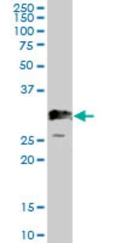 PDGFB, Mouse anti-Human, Polyclonal Antibody, Abnova 50 &mu;g | Buy Online | Abnova | Fisher Scientific