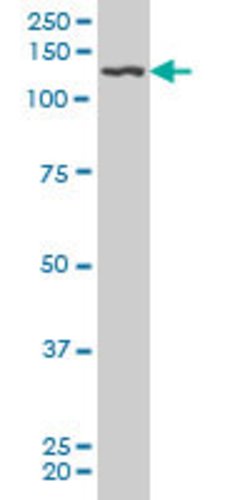 PDGFRB, Mouse anti-Human, Clone: 4C12, Abnova 100&mu;g; Unconjugated:Antibodies,