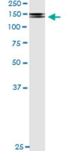 PDGFRB, Mouse anti-Human, Clone: 4C12, Abnova 100&mu;g; Unconjugated:Antibodies,