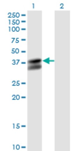 PDHB, Mouse anti-Human, Clone: 2B2, Abnova 100&mu;g; Unconjugated:Antibodies,