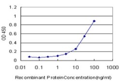 PDHB, Mouse anti-Human, Clone: 2B2, Abnova 100&mu;g; Unconjugated:Antibodies,