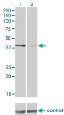 PDK2, Mouse anti-Human, Clone: 2G1, Abnova 100&mu;g; Unconjugated:Antibodies,