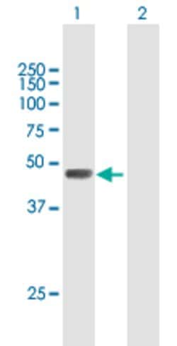 CFP, Mouse anti-Human, Polyclonal Antibody, Abnova 50 &mu;g | Buy Online | Abnova | Fisher Scientific