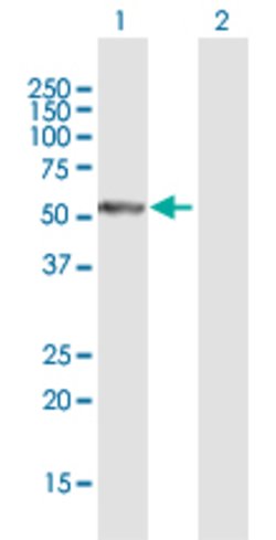 PFTK1, Mouse anti-Human, Polyclonal Antibody, Abnova 50&mu;g; Unconjugated:Antibodies,