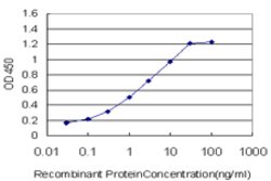 PGR, Mouse anti-Human, Clone: 4E9, Abnova 100&mu;g; Unconjugated:Antibodies,