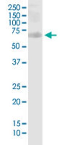 PHF1, Mouse anti-Human, Clone: 2G7, Abnova 100&mu;g; Unconjugated:Antibodies,