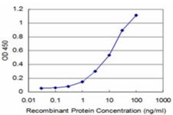 PHF1, Mouse anti-Human, Clone: 2G7, Abnova 100&mu;g; Unconjugated:Antibodies,
