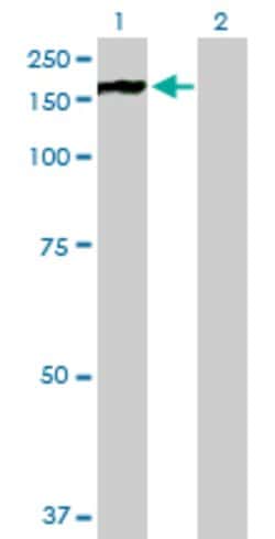 PHKA2, Mouse anti-Human, Polyclonal Antibody, Abnova 50&mu;g; Unconjugated:Antibodies,
