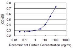 PHKA2, Mouse anti-Human, Clone: 1D4, Abnova 100&mu;g; Unconjugated:Antibodies,
