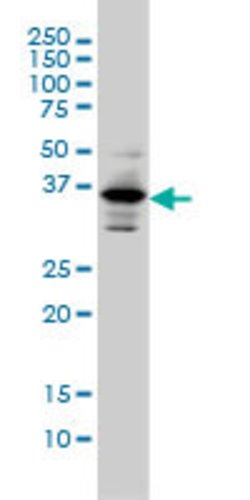 PITX1, Mouse anti-Human, Clone: 5G4, Abnova 100&mu;g; Unconjugated:Antibodies,