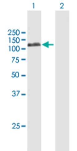 PLG, Rabbit anti-Human, Polyclonal Antibody, Abnova 100 &mu;L | Buy Online | Abnova | Fisher Scientific