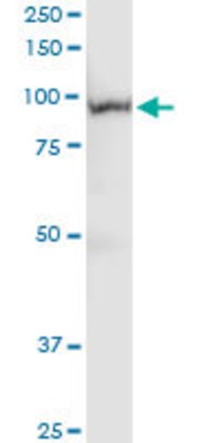 PLG, Rabbit anti-Human, Polyclonal Antibody, Abnova 100 &mu;L | Buy Online | Abnova | Fisher Scientific