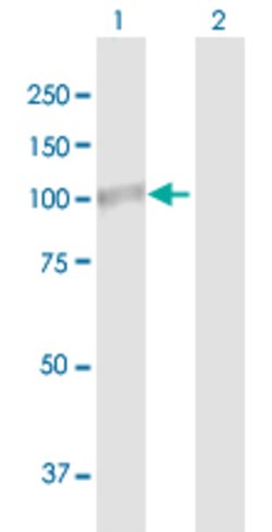PLOD2, Mouse anti-Human, Polyclonal Antibody, Abnova 50&mu;g; Unconjugated:Antibodies,