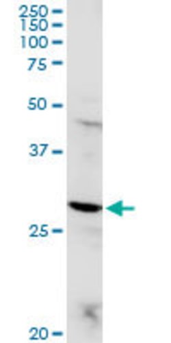POMC, Rabbit anti-Human, Polyclonal Antibody, Abnova 100 &mu;g | Buy Online | Abnova | Fisher Scientific