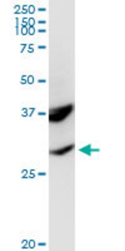 POMC, Rabbit anti-Human, Polyclonal Antibody, Abnova 100 &mu;g | Buy Online | Abnova | Fisher Scientific