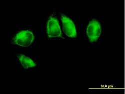 POR, Mouse anti-Human, Polyclonal Antibody, Abnova 50 &mu;g | Buy Online | Abnova | Fisher Scientific