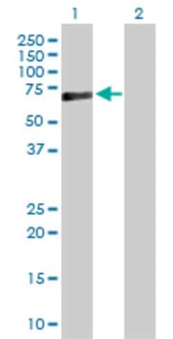 PRF1, Rabbit anti-Human, Polyclonal Antibody, Abnova 100&mu;g; Unconjugated:Antibodies,