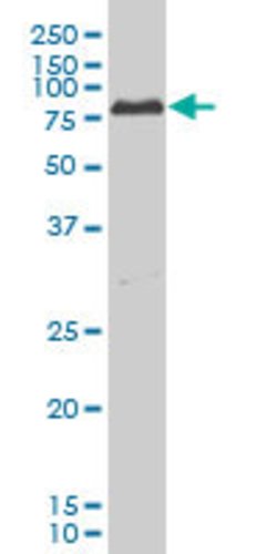 PRKCI, Mouse anti-Human, Clone: 1C10, Abnova 100 &mu;g | Buy Online | Abnova | Fisher Scientific