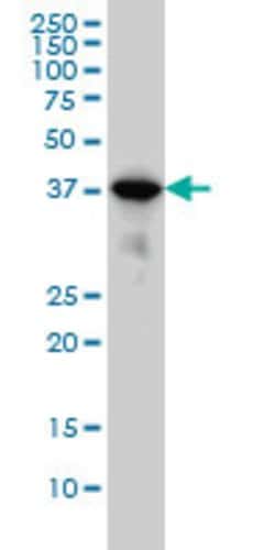 MAPK13, Mouse anti-Human, Clone: 2B2, Abnova 100&mu;g; Unconjugated:Antibodies,