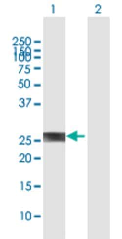 PROP1, Rabbit anti-Human, Polyclonal Antibody, Abnova 100&mu;L; Unconjugated:Antibodies,