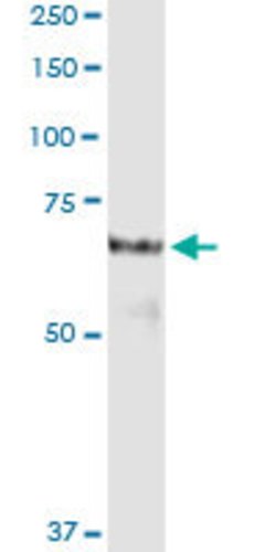 PROS1, Rabbit anti-Human, Polyclonal Antibody, Abnova 100&mu;L; Unconjugated:Antibodies,