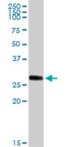 PRSS1, Rabbit anti-Human, Polyclonal Antibody, Abnova 100&mu;g; Unconjugated:Antibodies,