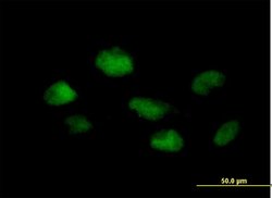 PSMB3, Mouse anti-Human, Polyclonal Antibody, Abnova 50&mu;g; Unconjugated:Antibodies,