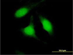 PSME2, Mouse anti-Human, Polyclonal Antibody, Abnova 50&mu;g; Unconjugated:Antibodies,