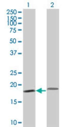 PTH, Mouse anti-Human, Clone: 3H7, Abnova 100&mu;g; Unconjugated:Antibodies,