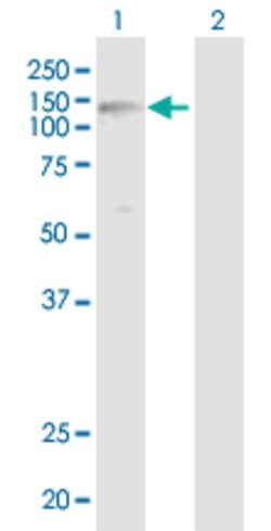 PYGB, Rabbit anti-Human, Polyclonal Antibody, Abnova 100 &mu;L | Buy Online | Abnova | Fisher Scientific