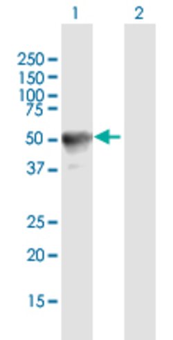 RAB3IL1, Mouse anti-Human, Polyclonal Antibody, Abnova 50&mu;g; Unconjugated:Antibodies,